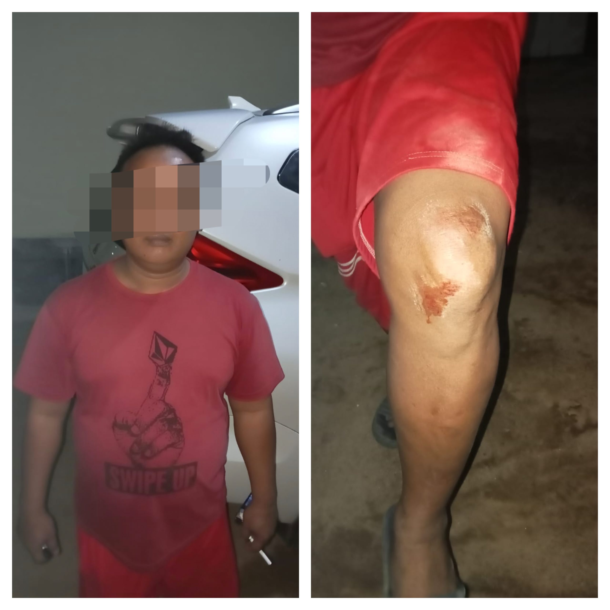 RN cs” Warga Tanjung Ratu Intimidasi Warga Tanjung Agung Salah Satu Korban Babak Belur