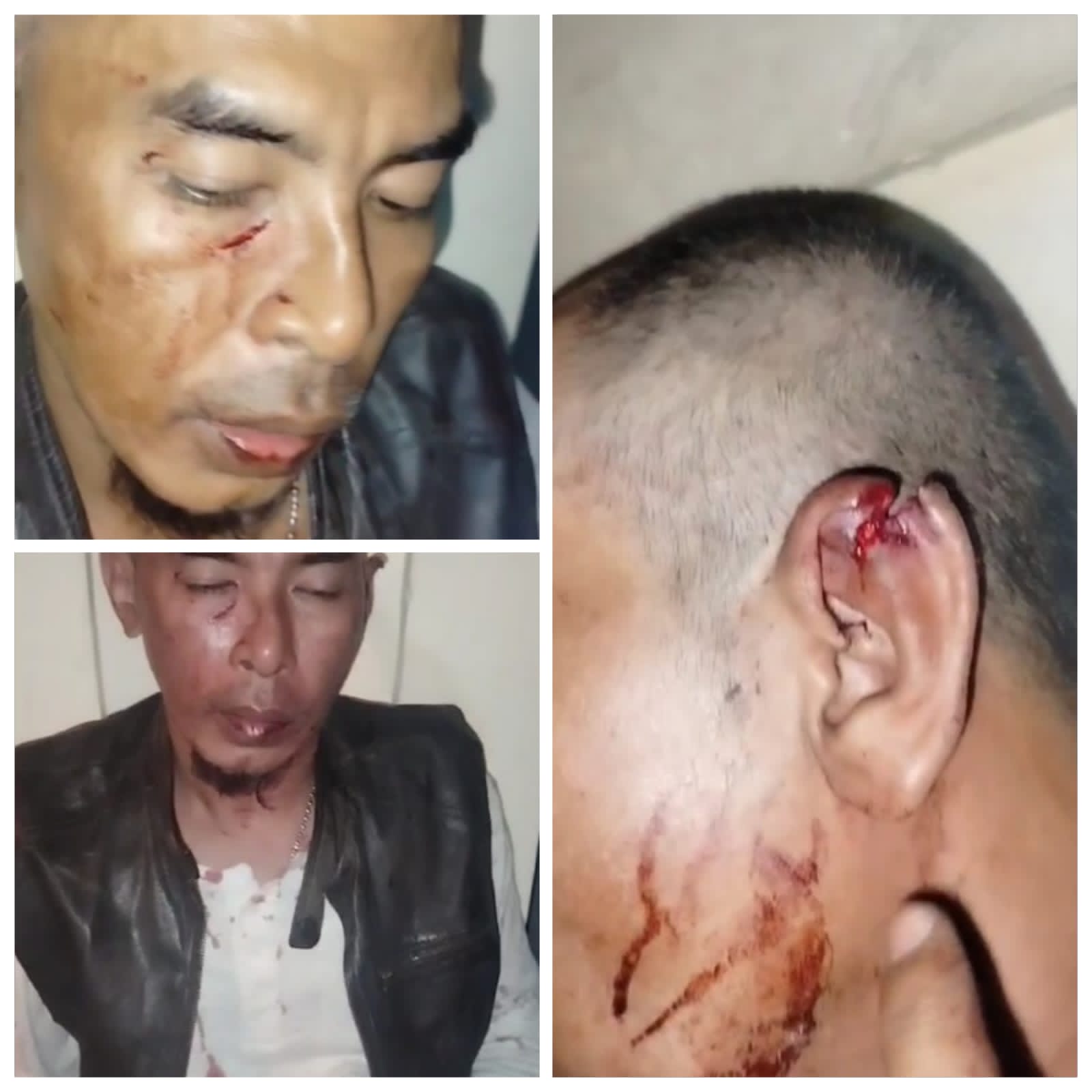 FWJ Indonesia Gaungkan Subang Zona Merah, Pengeroyokan Jurnalis Terjadi 2 Kali Dalam Hitungan Seminggu