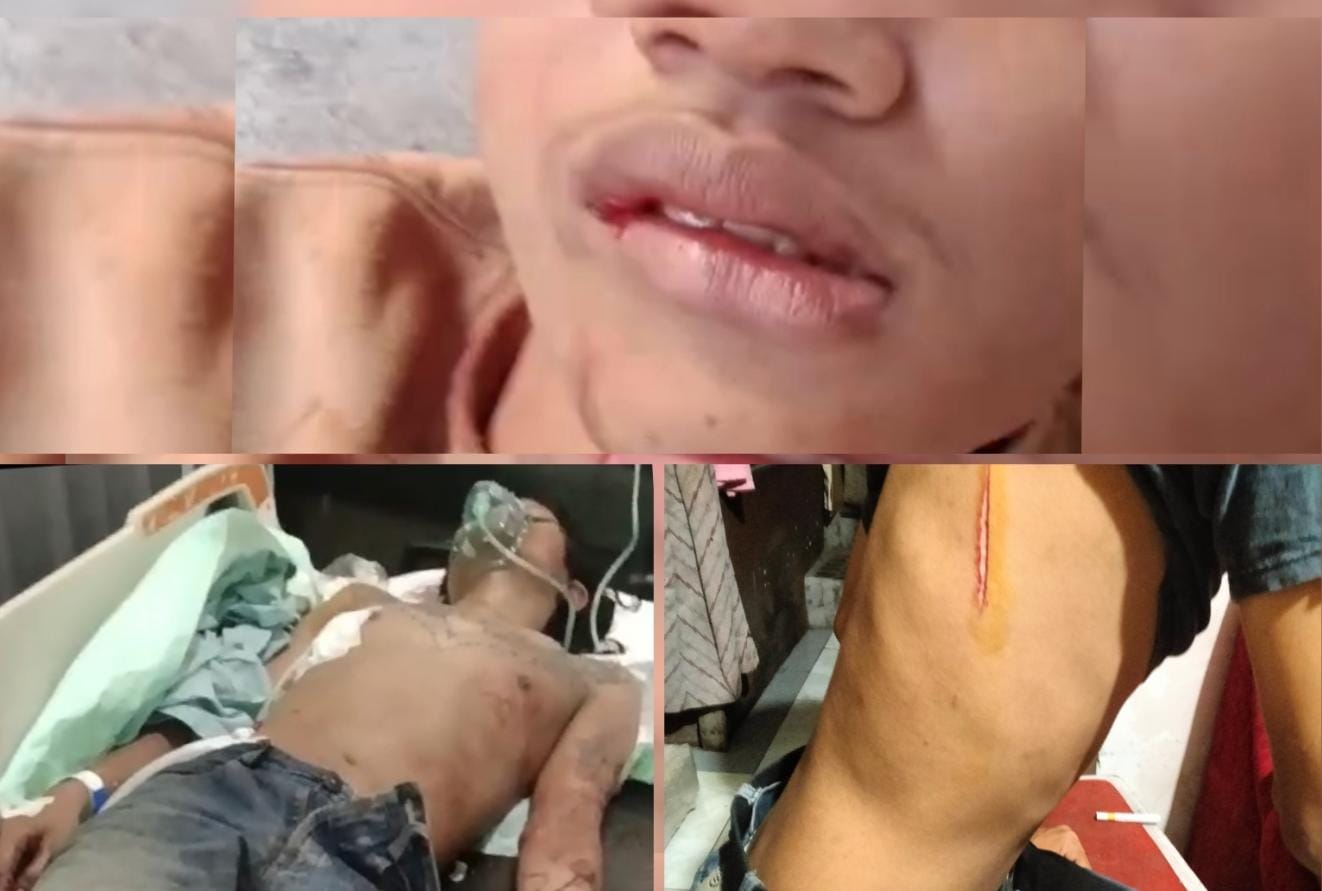 Geger..!! Akibat Pesta Miras Tiga Remaja Pengamen Jalanan Jadi Korban Bacok