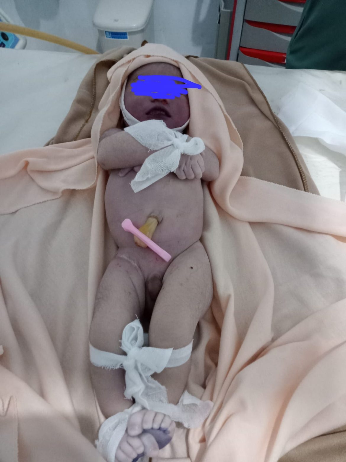 Bayi Meninggal Diduga Karena Kelalaian RSU Linggajati, Direktur Akui Belum Dapat Laporan